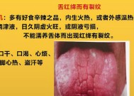 舌裂的原因及预防方法（探讨舌头出现裂纹的原因）