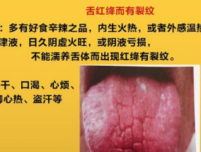 舌裂的原因及预防方法（探讨舌头出现裂纹的原因）